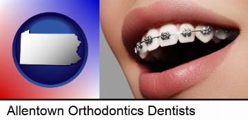 orthodontic braces in Allentown, PA