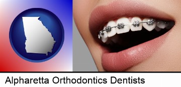 orthodontic braces in Alpharetta, GA