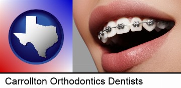 orthodontic braces in Carrollton, TX