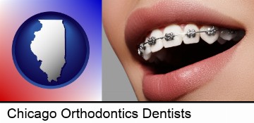 orthodontic braces in Chicago, IL