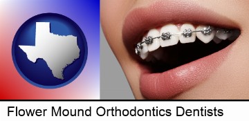 orthodontic braces in Flower Mound, TX