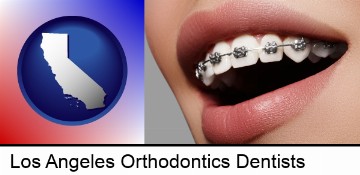 orthodontic braces in Los Angeles, CA