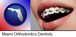 Miami, Florida - orthodontic braces