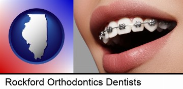 orthodontic braces in Rockford, IL