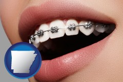 arkansas map icon and orthodontic braces