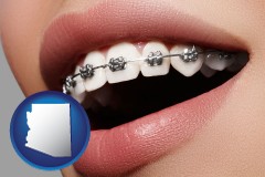 arizona map icon and orthodontic braces