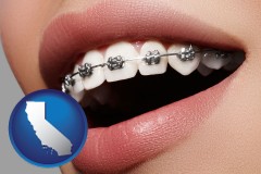california map icon and orthodontic braces