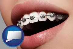 connecticut map icon and orthodontic braces
