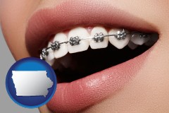 iowa map icon and orthodontic braces