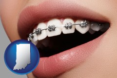 indiana map icon and orthodontic braces