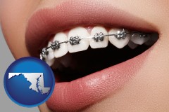 maryland map icon and orthodontic braces