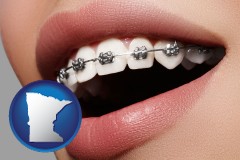 minnesota map icon and orthodontic braces