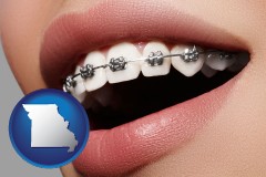 missouri map icon and orthodontic braces