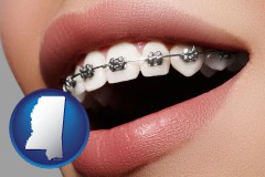 mississippi map icon and orthodontic braces