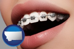 montana map icon and orthodontic braces