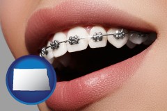 nd map icon and orthodontic braces