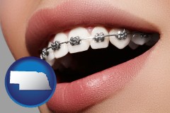 nebraska map icon and orthodontic braces