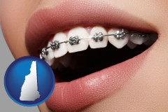 new-hampshire map icon and orthodontic braces
