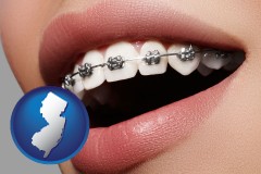 new-jersey map icon and orthodontic braces