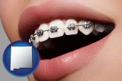 new-mexico map icon and orthodontic braces
