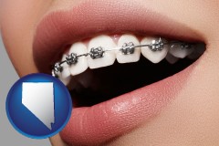 nevada map icon and orthodontic braces