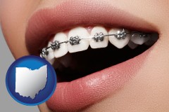 ohio map icon and orthodontic braces
