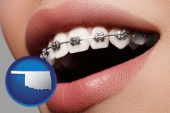 oklahoma map icon and orthodontic braces