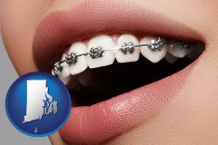 rhode-island map icon and orthodontic braces