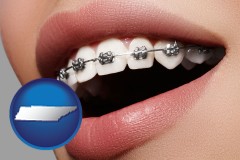 tennessee map icon and orthodontic braces