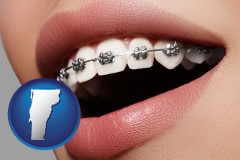 vermont map icon and orthodontic braces