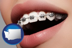 washington map icon and orthodontic braces