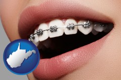 west-virginia map icon and orthodontic braces