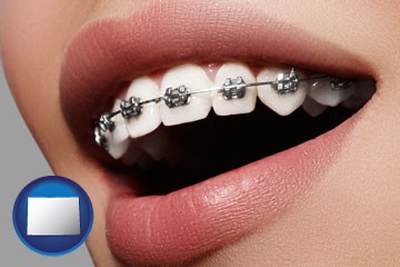 orthodontic braces - with Colorado icon