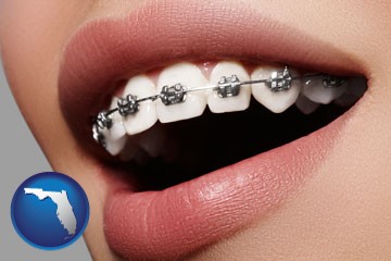 orthodontic braces - with Florida icon