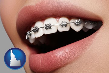 orthodontic braces - with Idaho icon