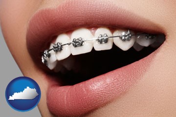orthodontic braces - with Kentucky icon