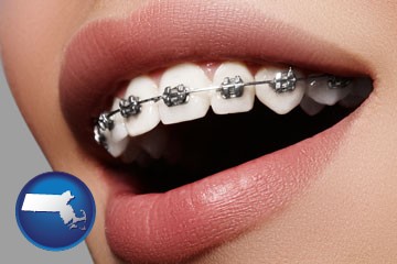orthodontic braces - with Massachusetts icon