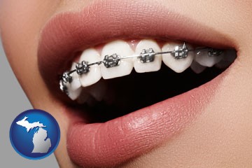 orthodontic braces - with Michigan icon