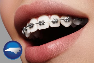 orthodontic braces - with North Carolina icon
