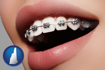 orthodontic braces - with New Hampshire icon
