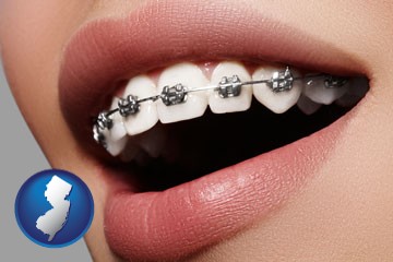 orthodontic braces - with New Jersey icon