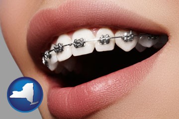 orthodontic braces - with New York icon