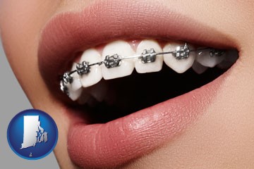 orthodontic braces - with Rhode Island icon