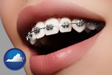 orthodontic braces - with Virginia icon
