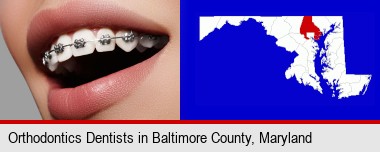 orthodontic braces; Baltimore County highlighted in red on a map