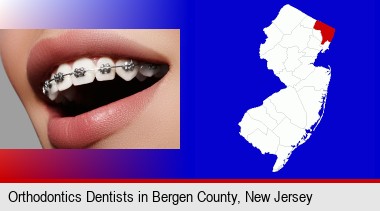 orthodontic braces; Bergen County highlighted in red on a map
