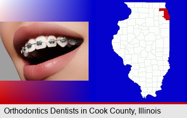 orthodontic braces; Cook County highlighted in red on a map