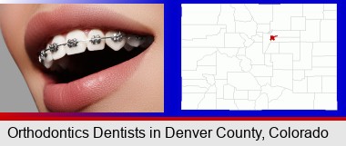 orthodontic braces; Denver County highlighted in red on a map
