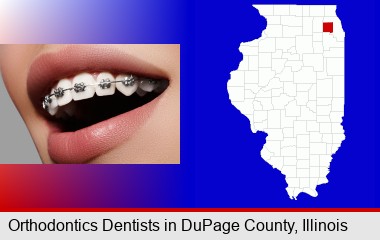 orthodontic braces; DuPage County highlighted in red on a map