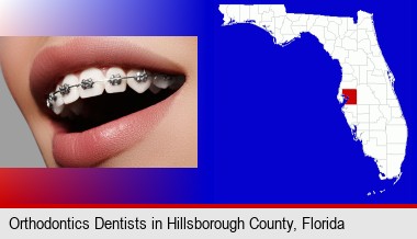 orthodontic braces; Hillsborough County highlighted in red on a map